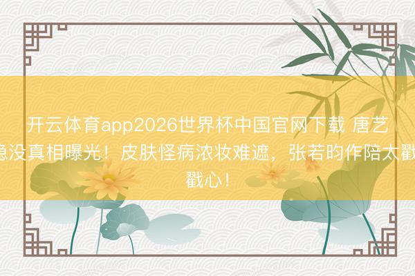 开云体育app2026世界杯中国官网下载 唐艺昕隐没真相曝光！皮肤怪病浓妆难遮，张若昀作陪太戳心！